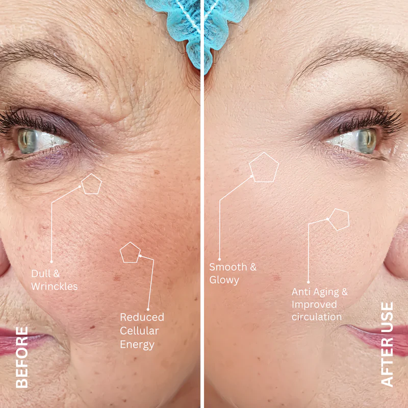 RED LIGHT THERAPY AT HOME