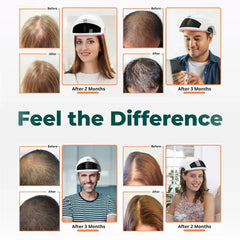 red light therapy for hair loss