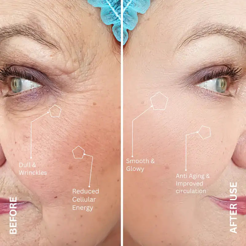 Why Red Light Therapy Works — Backed by Science