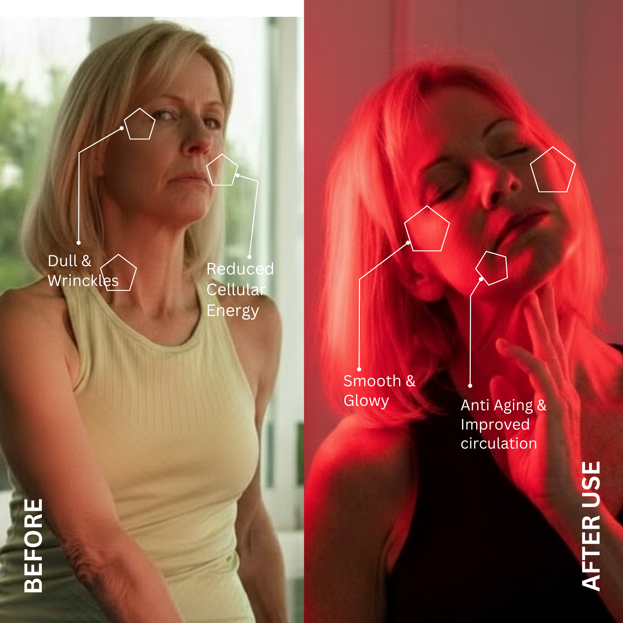 FX300 red light therapy device with adjustable stand for face and neck use